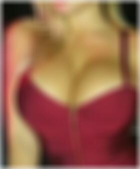 escort en Manzanares Rosario